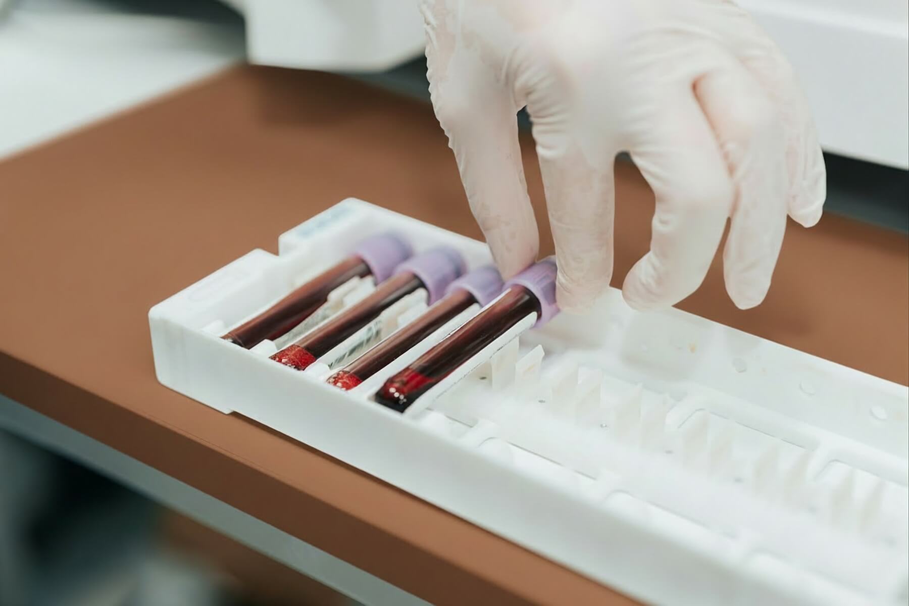 Vials of blood for testing